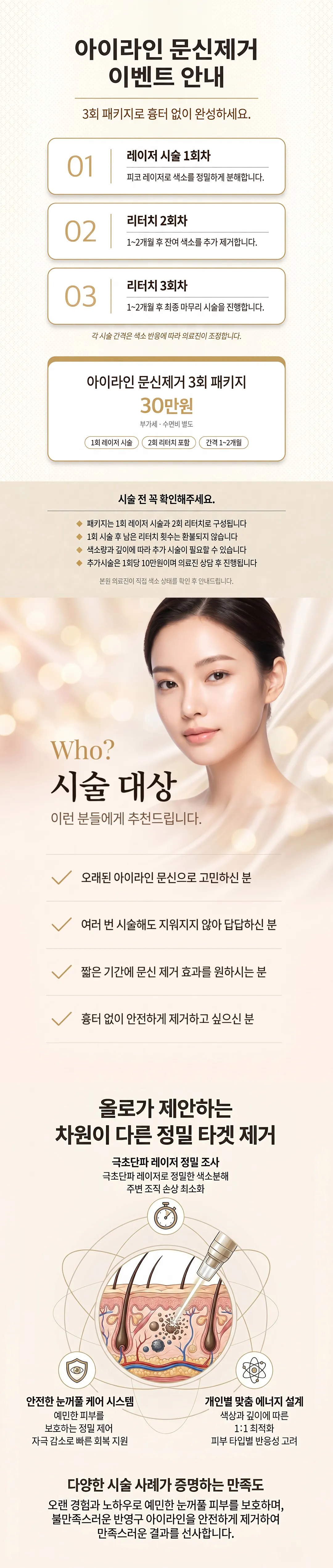 올로성형외과 아이라인 문신제거 이벤트 안내